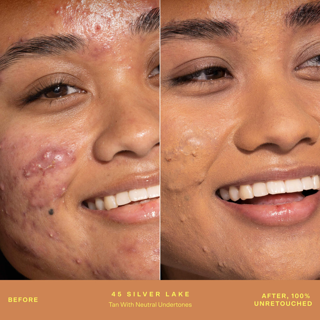 SunnyDays™ Tinted SPF 30 H4
