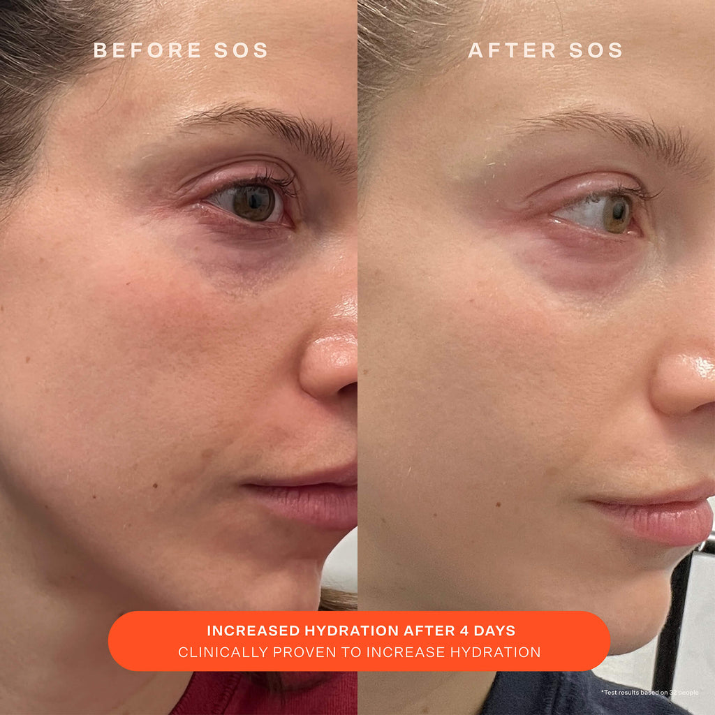 SOS Recovery Cream T6