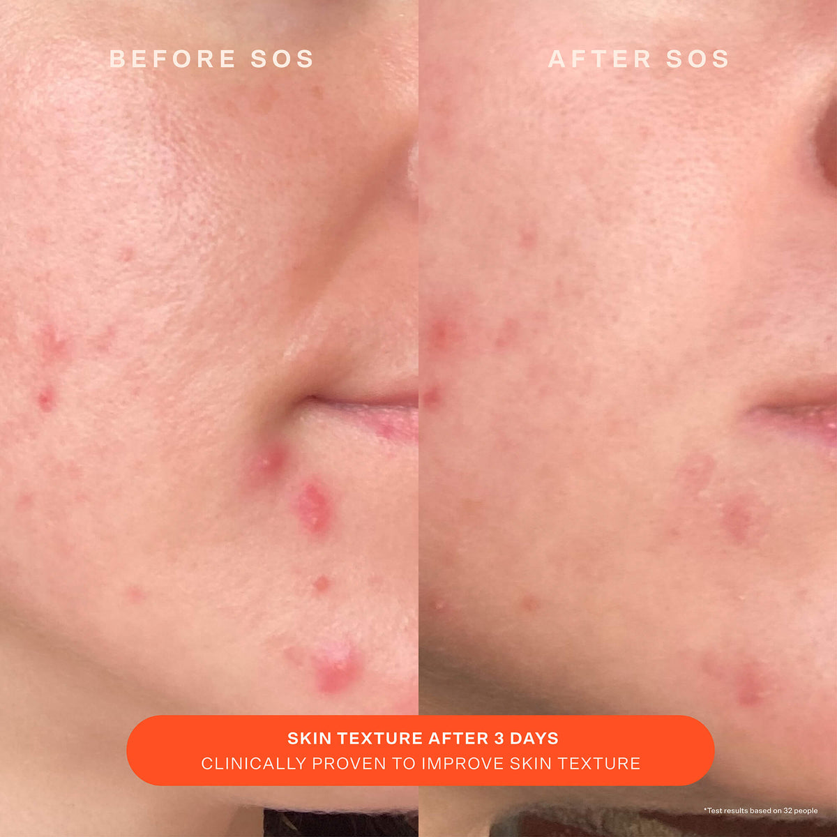 SOS Recovery Cream T6