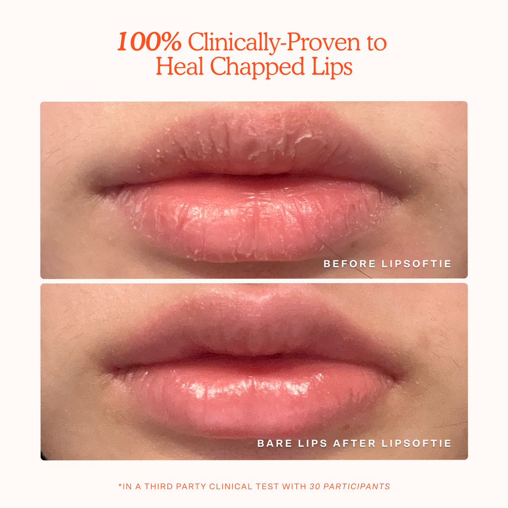 LipSoftie® Lip Treatment B0