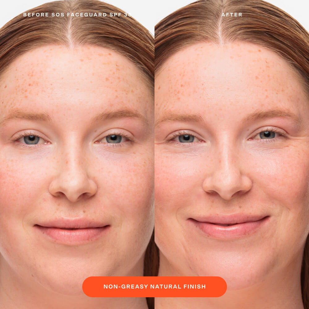 SOS FaceGuard™ SPF 30 Sunscreen PA+++ Q5