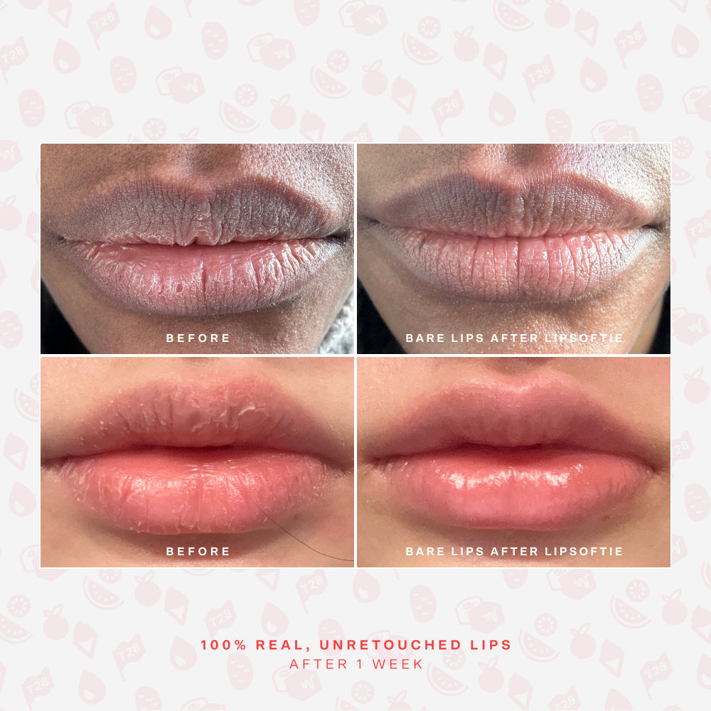 LipSoftie® Lip Treatment Set H8