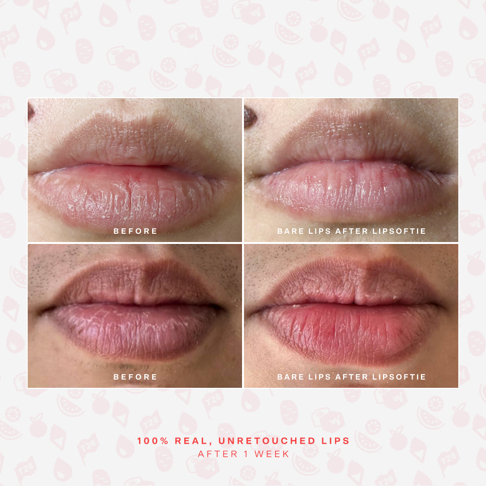 LipSoftie® Lip Treatment Set H8