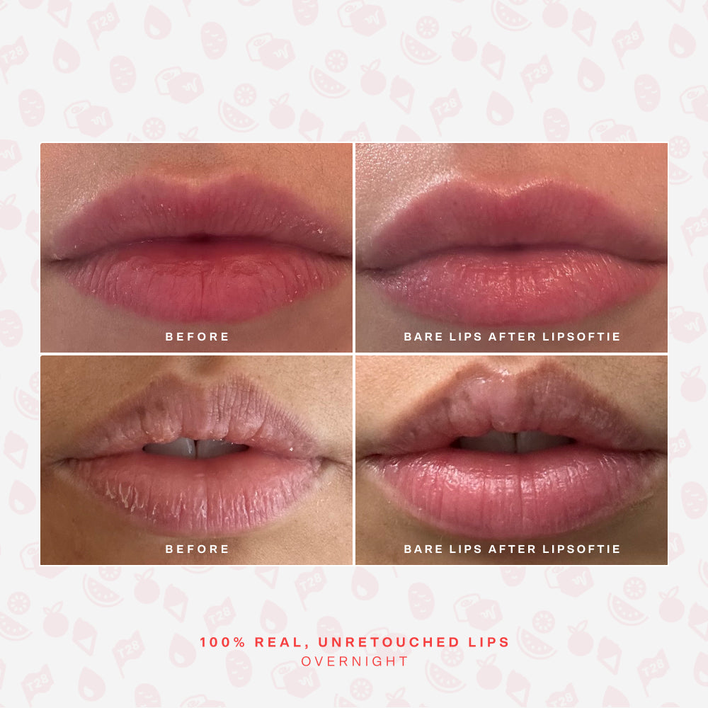 LipSoftie® Lip Treatment Set H8