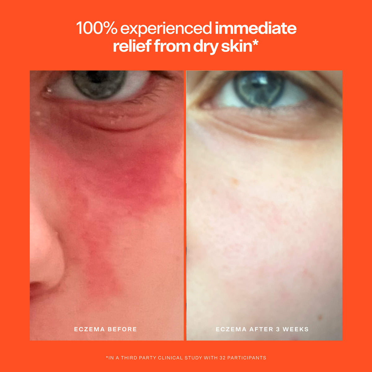 SOS Rescue Serum Y2