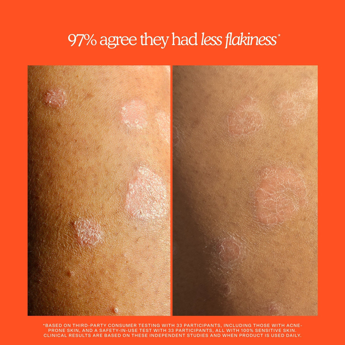 SOS Rescue + Relief Body Wash Treatment H0