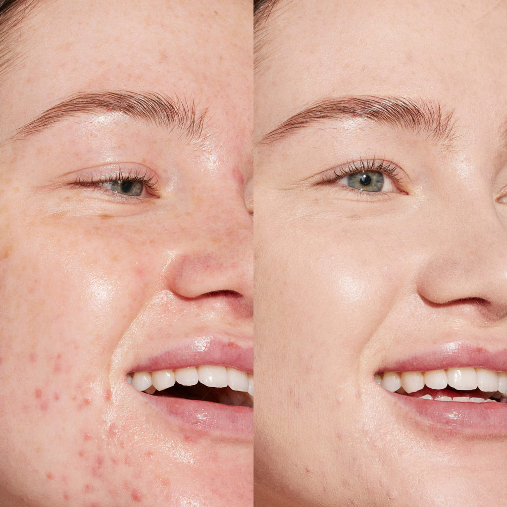 Swipe Serum Concealer® N3
